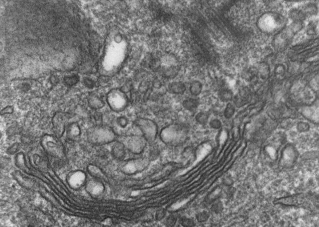 Transmission electron microscope image of the Golgi lattice