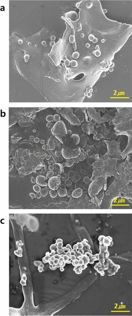 Lisosomi estratti dalle cellule HeLa trattati con un precursore coinvolto nella sintesi dell'etilene (ormone delle piante). [Fonte:https://researchgate.com]