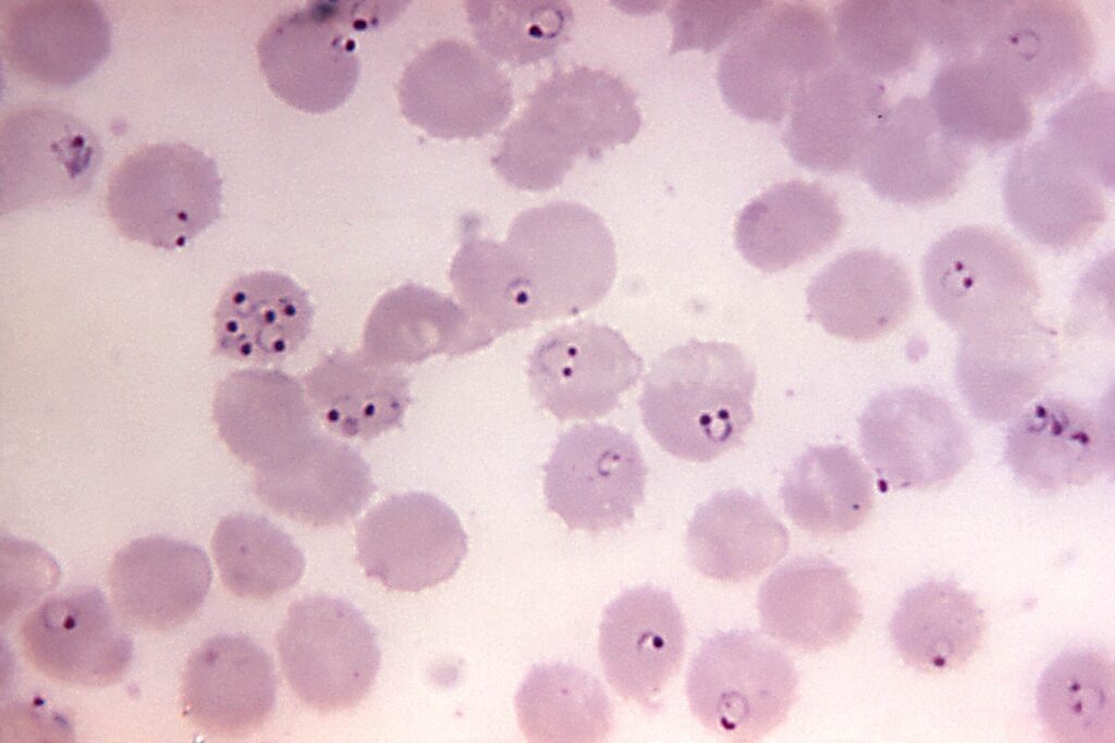 striscio di sangue infetto con plasmodium spp. 
