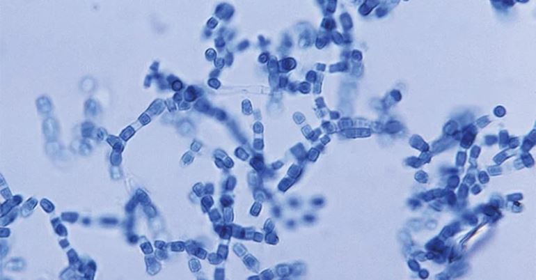 Figura 1 – C. immitis al microscopio ottico