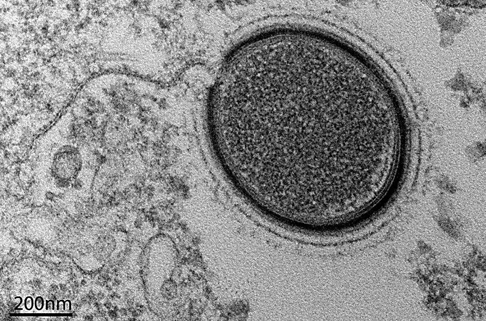 Figure 2 – Giant virus: Mollivirus sibericum – [Credit: repubblica.it]