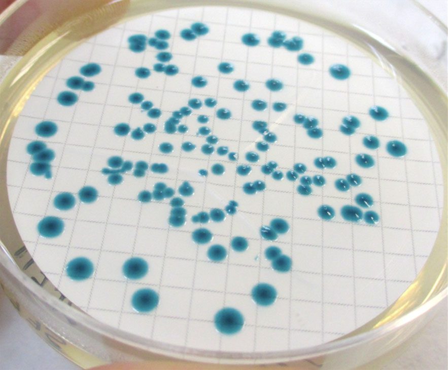 Crescita di Escherichia coli su TBX Agar