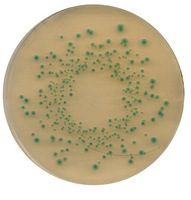 Crescita di Escherichia coli ATCC 25922 su TBX Agar