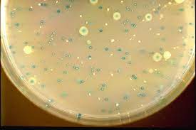 TBX Agar: Escherichia coli (colonie blu) e Enterobacter aerogenes (colonie incolori)