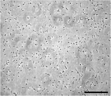 Halorubrum lacusprofundi microscopia