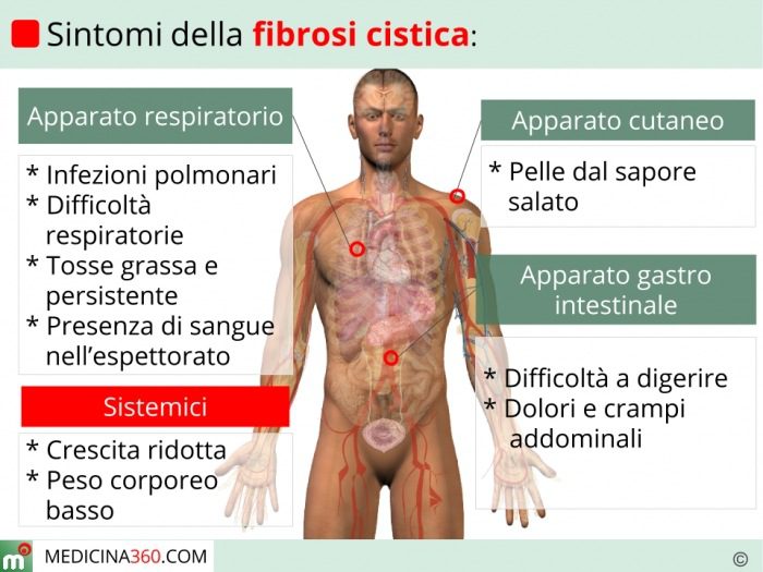 Figura 2 - Sintomi della Fibrosi Cistica