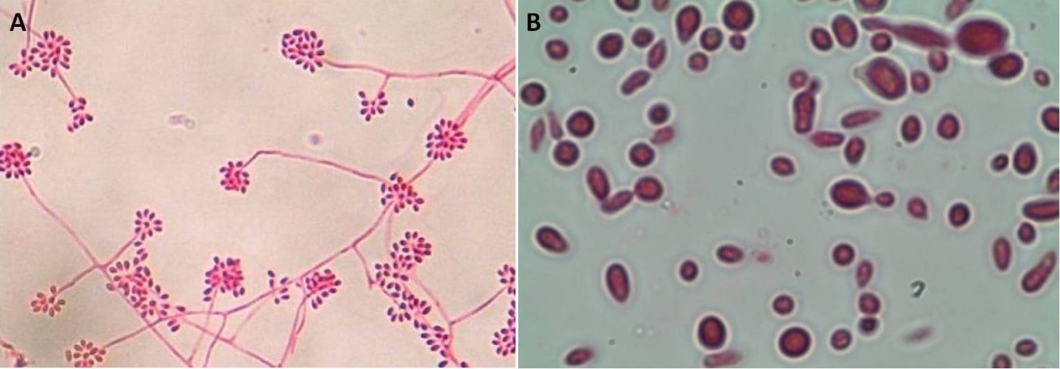 Sporothrix Schenckii Scheda Micologica E Approfondimenti 2925