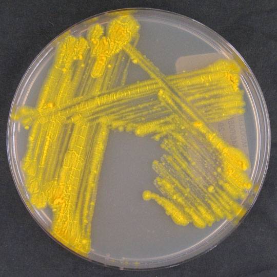 Mycobacterium marinum su Middlebrook agar