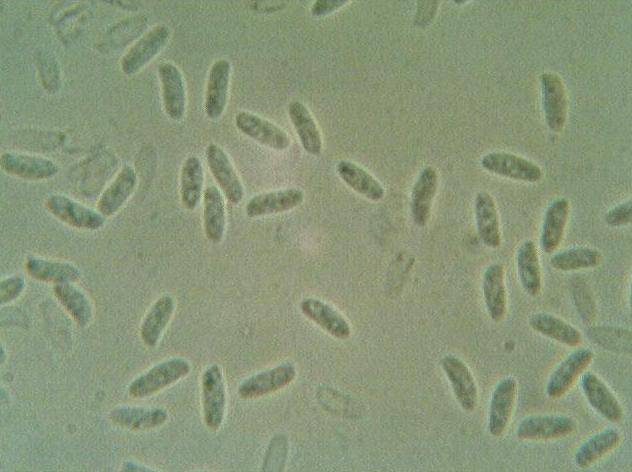 Figura 4 – Spore di P. ostreatus