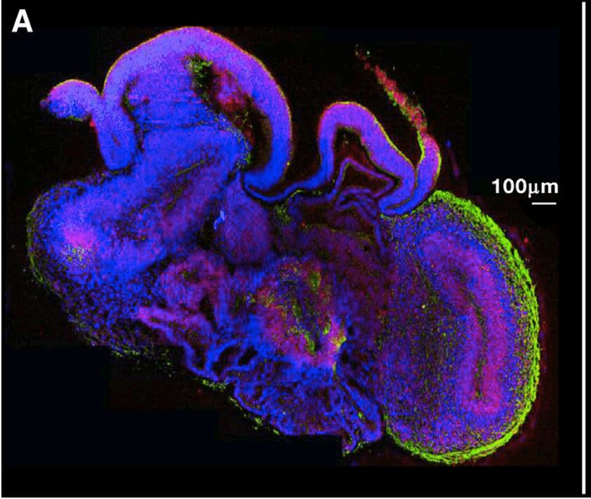 mini brain, organoide di cervello umano 