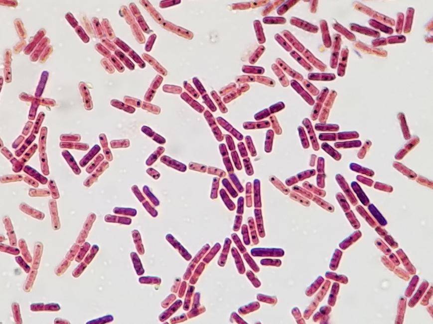 escherichia coli al microscopio