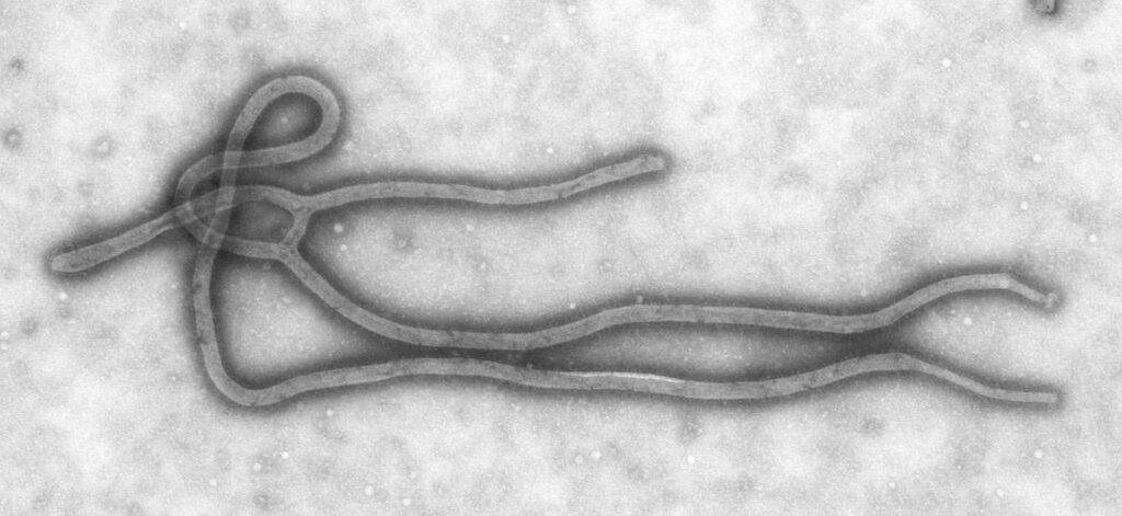 Figura 1 - Ebolavirus al microscopio elettronico
