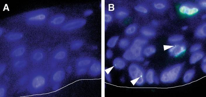 Figura 10 – Ibridazione in situ con sonde fluorescenti su cheratinociti normali (A) e su cheratinociti infettati con HPV-16 (B). I segnali luminosi indicano la presenza del genoma virale (punte di freccia)