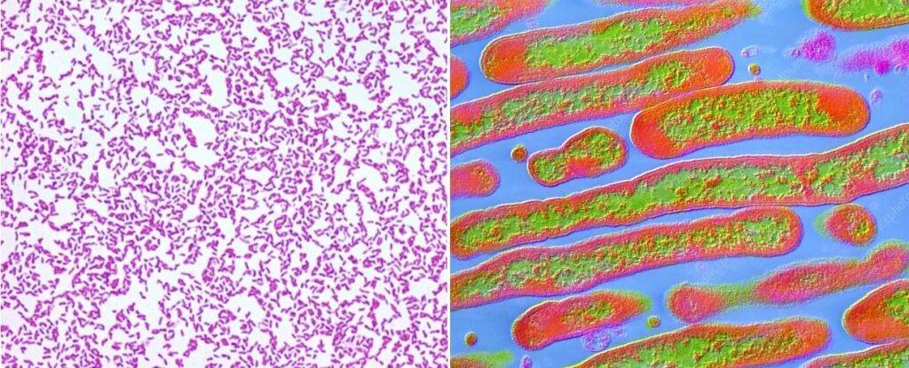 Figura 1 - E. meningoseptica al microscopio ottico (sinistra) e al microscopio elettronico a trasmissione (destra)