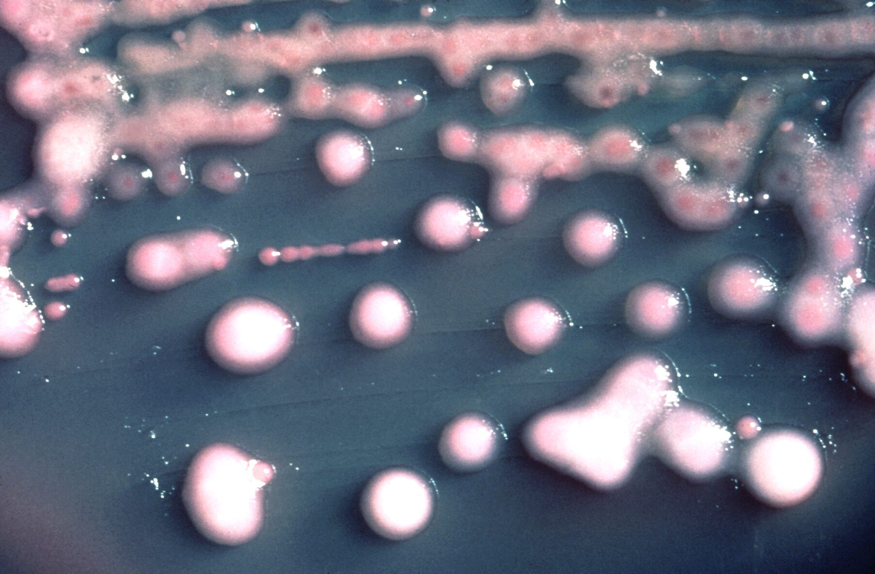 Klebsiella pneumoniae