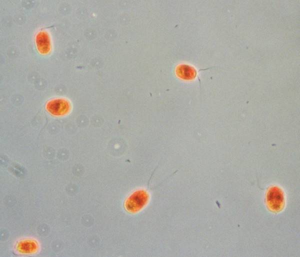 Cellule di Dunaliella salina osservate al microscopio ottico