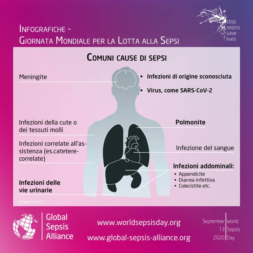 Infografica sulle cause più comuni della sepsi, da queste è possibile applicare determinate analisi.