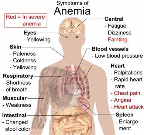 sintomi anemia 