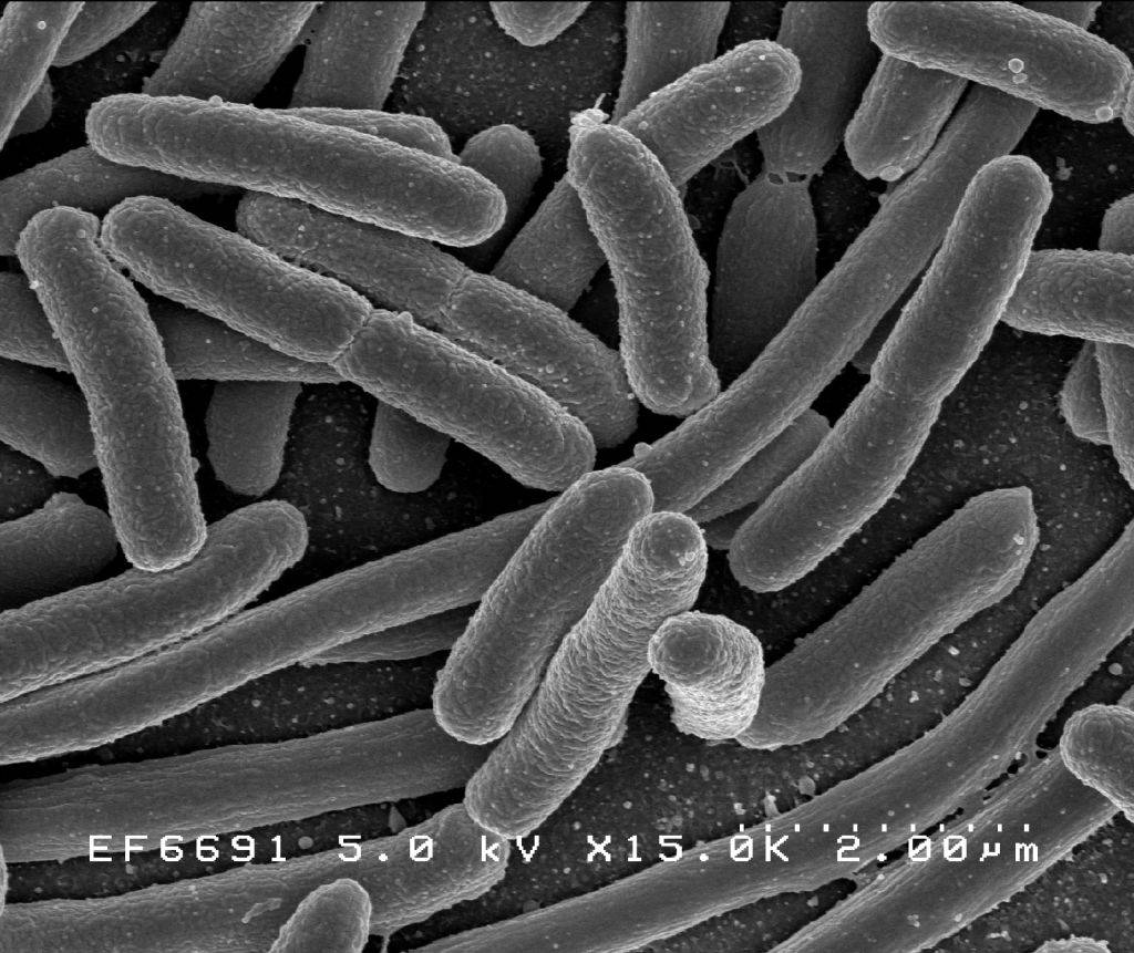 Escherichia coli al microscopio elettronico a scansione