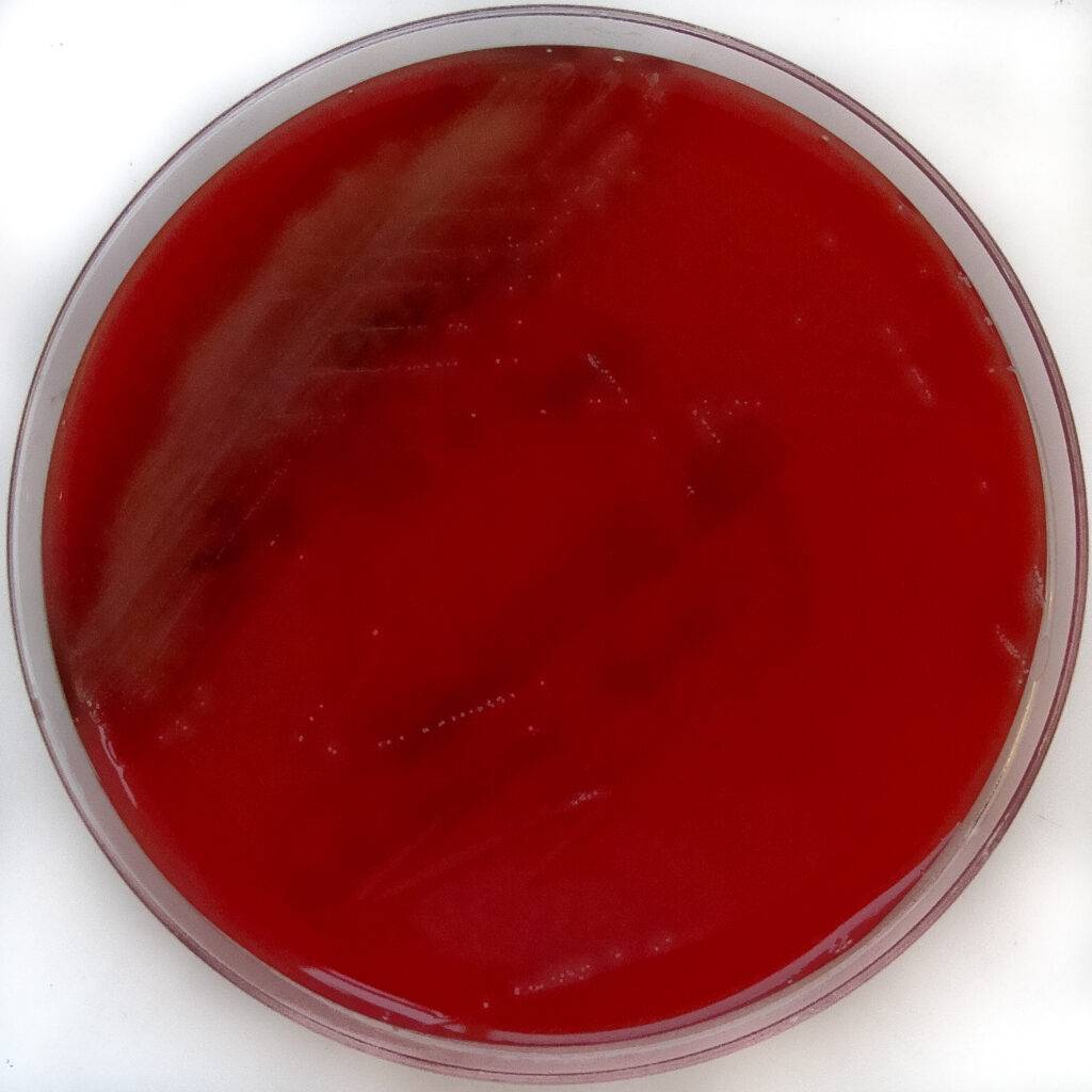 Colonia di Streptococcus constellatus in piastra Petri su terreno Columbia Blood Agar
