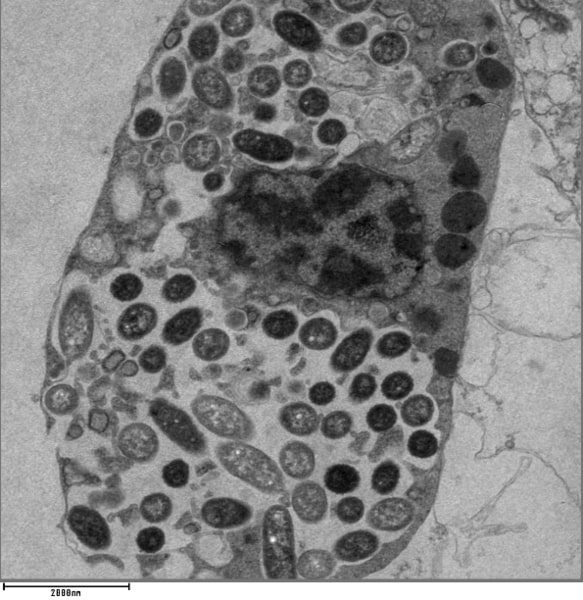 Osservazione al microscopio di una colonia all'interno di una cellula