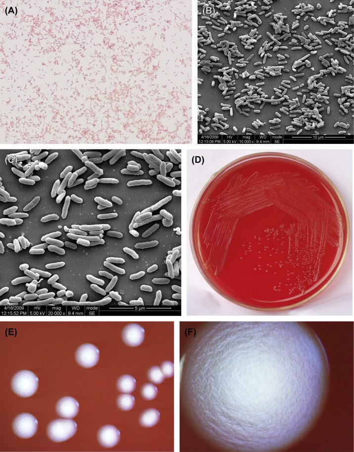 Alcune immagini di Aggregatibacter actinomycetemcomitans, l batterio alla base della malattia parodontale ai denti e dell’artrite reumatoide