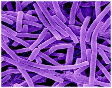 Bacillus Anthracis