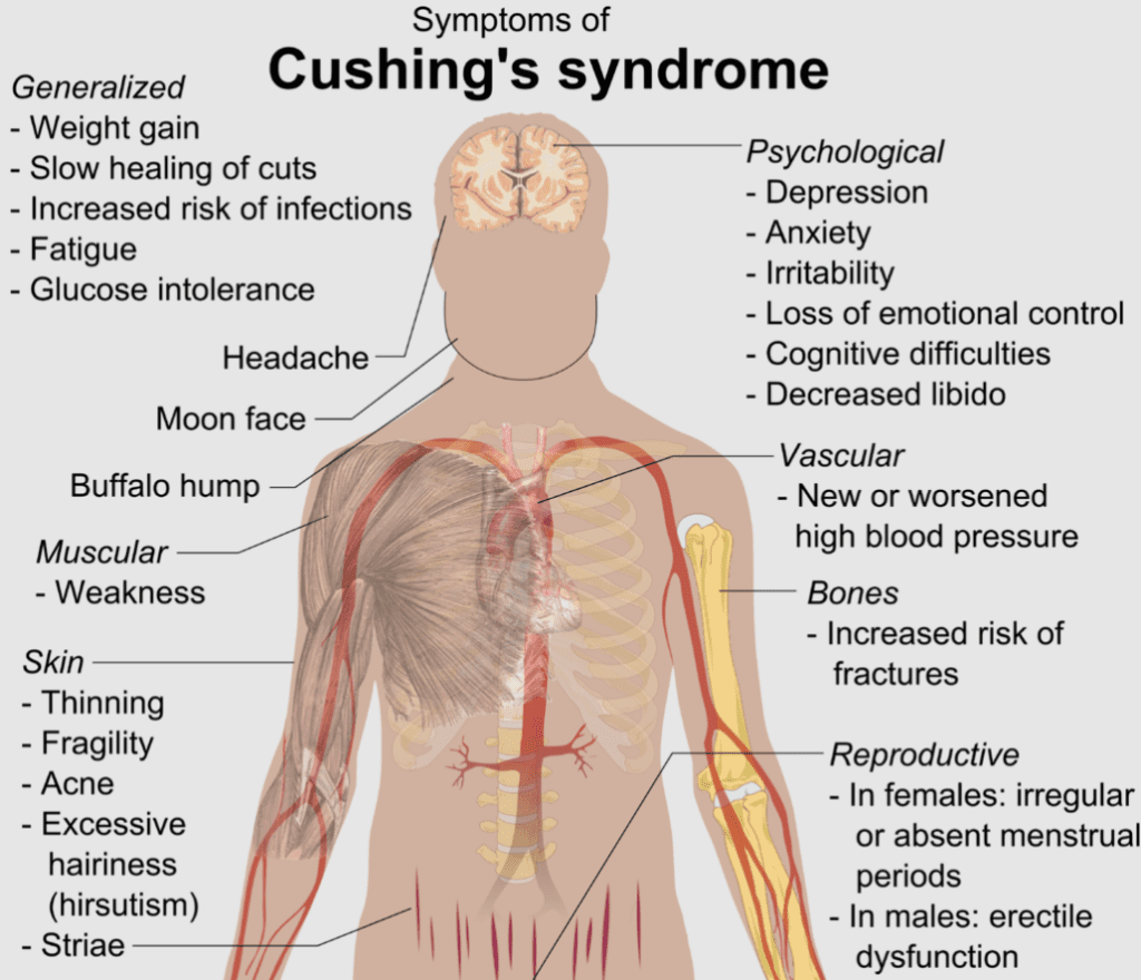 Sintomi della sindrome di Cushing