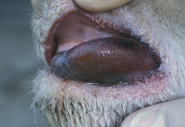 Bluetongue acuta negli ovini con grave rigonfiamento delle labbra ed erosioni sul muso