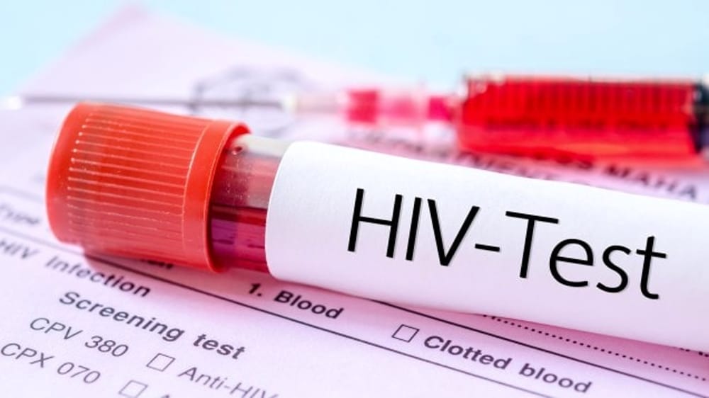 HIV-test di screening gratuito per le IST