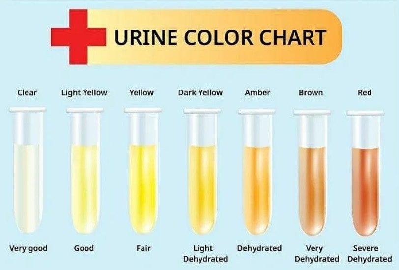 Il colore delle urine è indicativo del nostro stato di idratazione