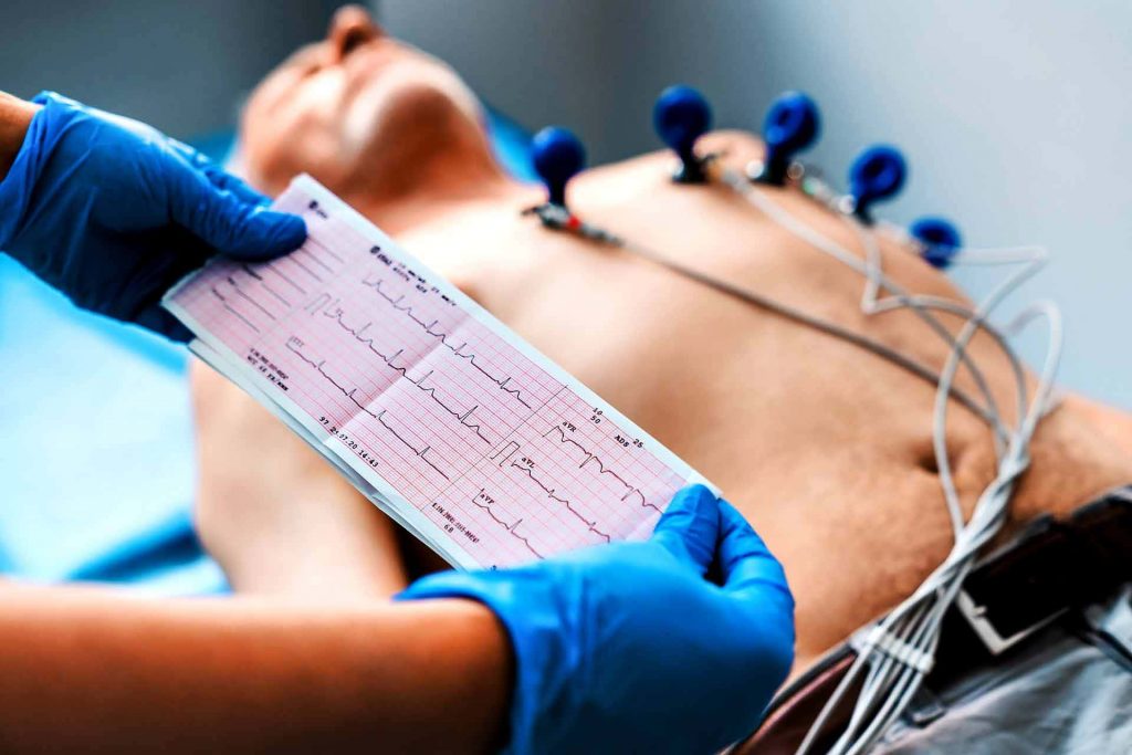 Elettrocardiogramma (ECG) per la diagnosi delle valvulopatie