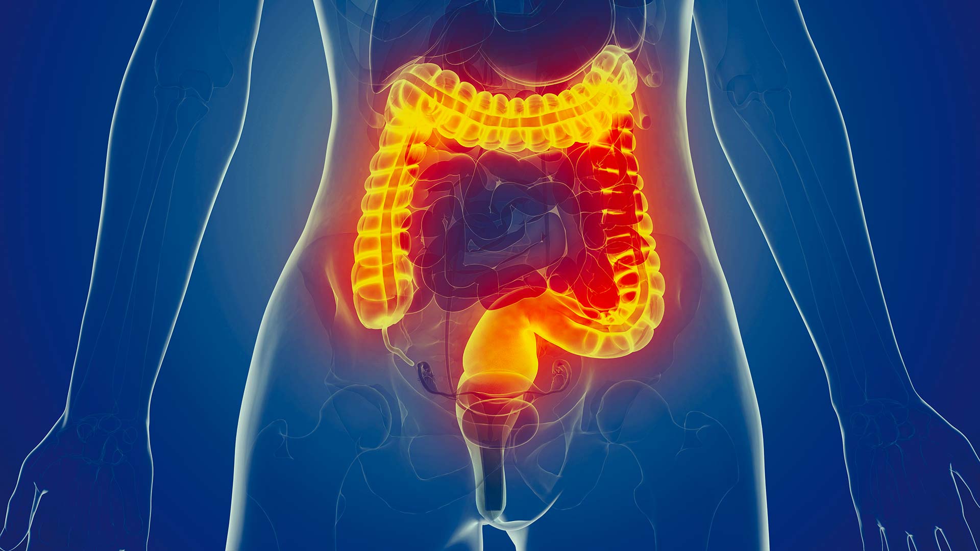 Sindrome Del Colon Irritabile (IBS): Sintomi, Cause E Trattamenti