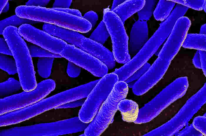 Infezioni da Escherichia coli nei Neonati