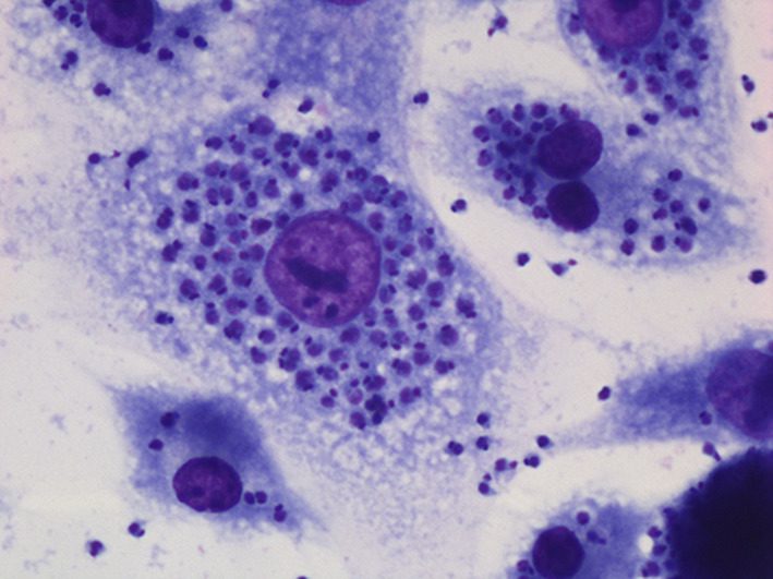 Tripanosomi, agenti di parassitosi. Macrofagi di topo cresciuti in coltura cellulare e infettati da forme di T. cruzi prive di flagello. Colorazione di Giemsa, immagine al microscopio ottico