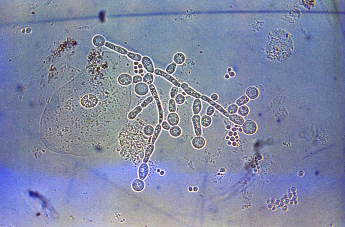 Microrganismi che producono tossine nelle micosi: Candida albicans sotto forma di cellule tondeggianti e filamenti. 