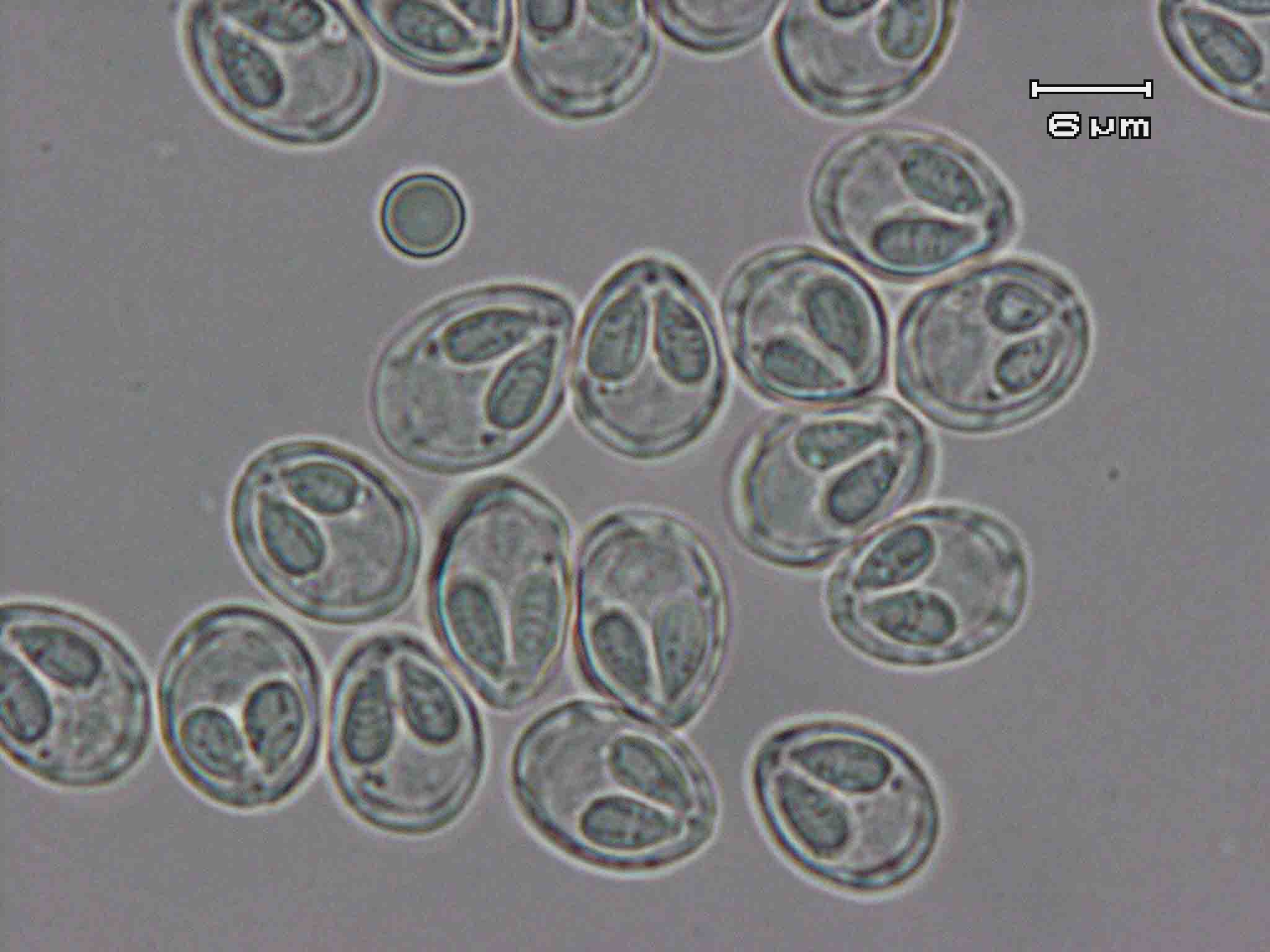 Myxobolus nagaraensis della classe dei Myxozoa