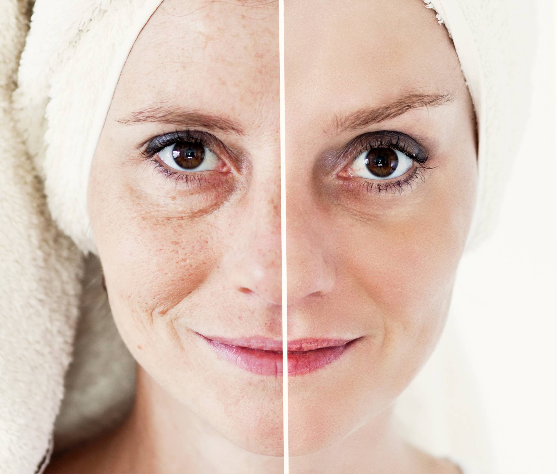 Skin Aging Obsession: What the Experts Say
