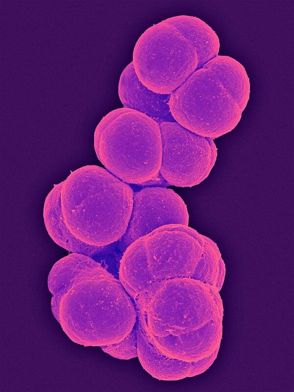 Methanotrophica-Archaea