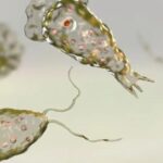 infezione da Acanthamoeba