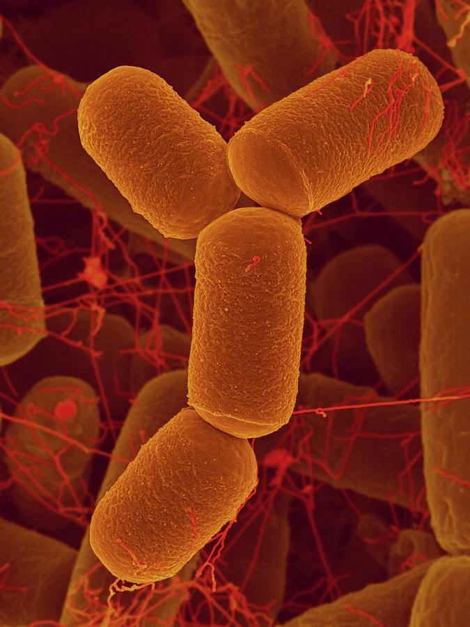 Methanobrevibacter-Smithii