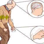 Diagnosi del Morbo di Parkinson