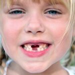 Come Capire se Sta Cadendo il Dentino a Tuo Figlio