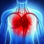 Trattamento dell'Insufficienza Cardiaca