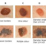 Neo di colore e spessore brutto