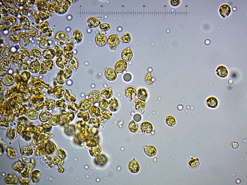 Spore di fungo dell'ulivo, osservazione in microscopia 1000x in reagente di Melzer anionico.