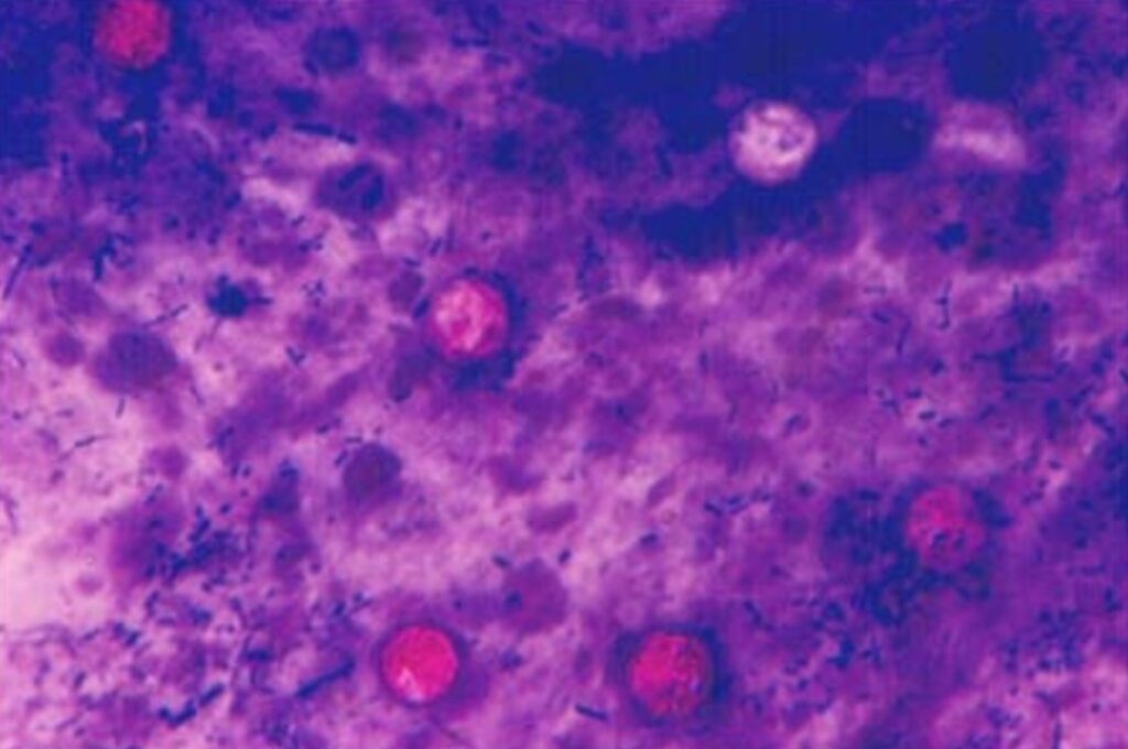 Oocisti di Cyclospora cayetanensis in un campione di feci.