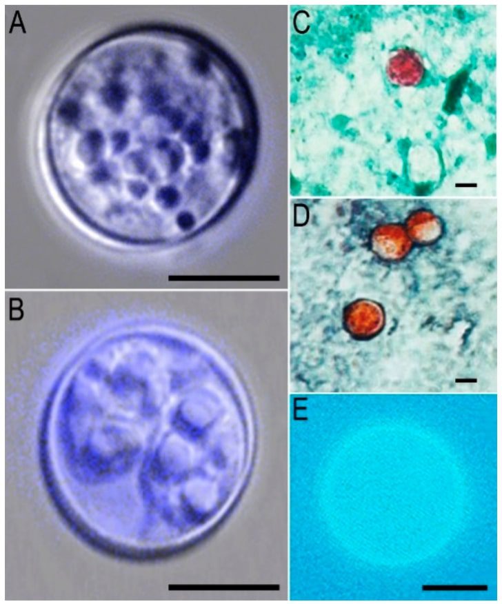 Oocisti di Cyclospora cayetanensis osservate al microscopio con diverse tipologie di contrasti e colorazioni. Nell'immagine E si evidenzia la fluorescenza ultravioletta.