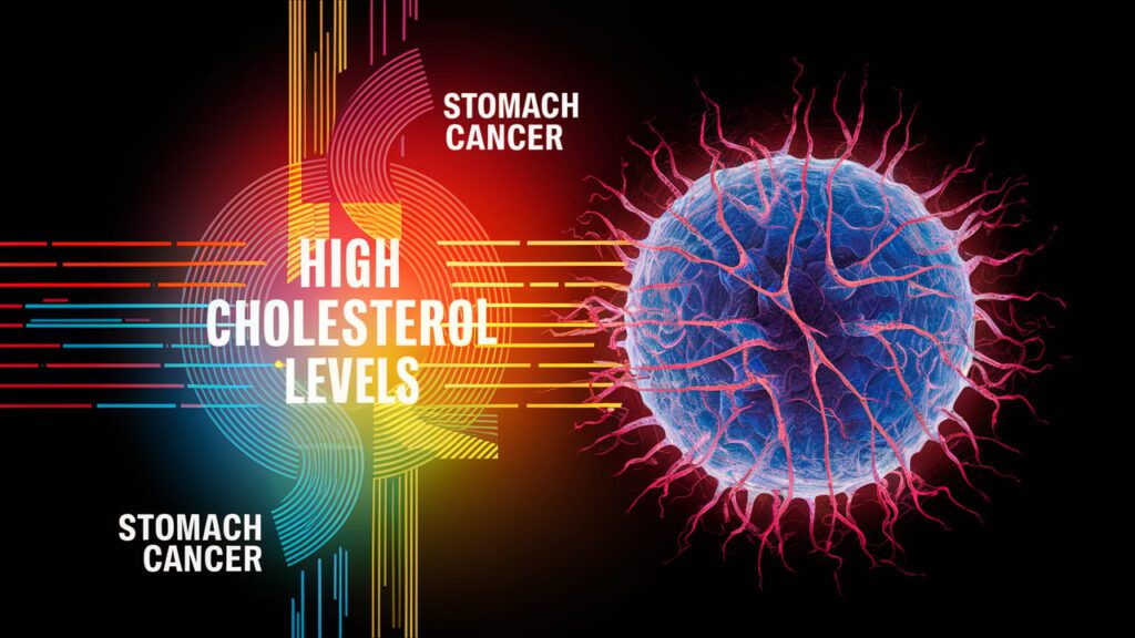 Colesterolo alto in persone con tumore allo stomaco