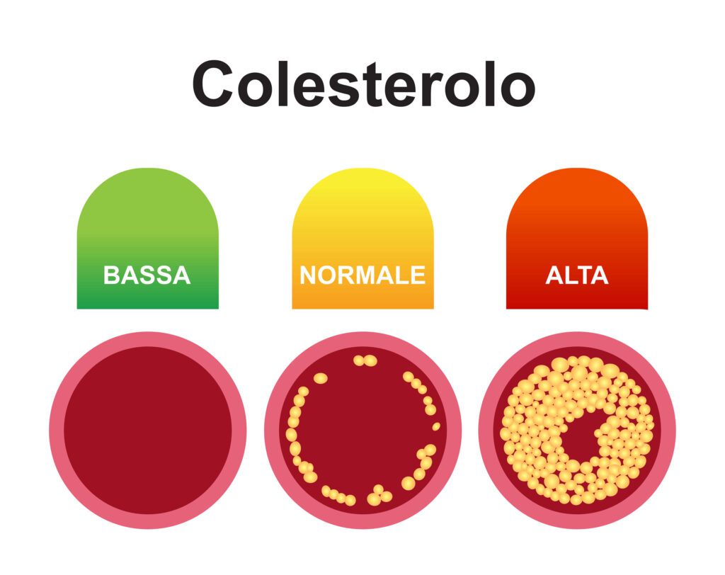 Rischio del colesterolo per la nostra salute